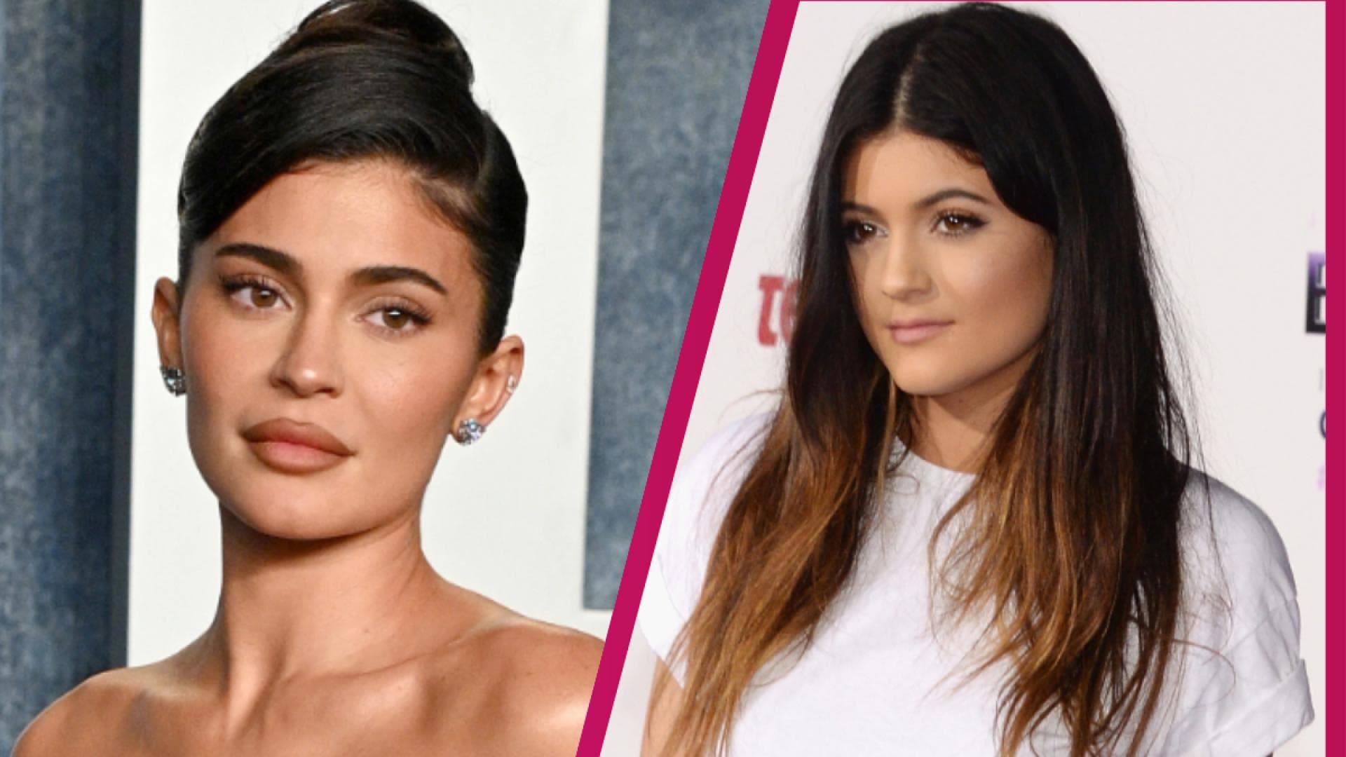 Kylie Jenner: Now she’s opening up about her cosmetic surgeries