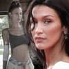 Bella Hadid zeigt sich mit verwundetem Arm