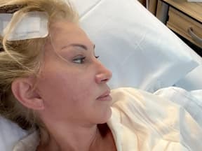 Carmen Geiss nach OP mit Pflaster