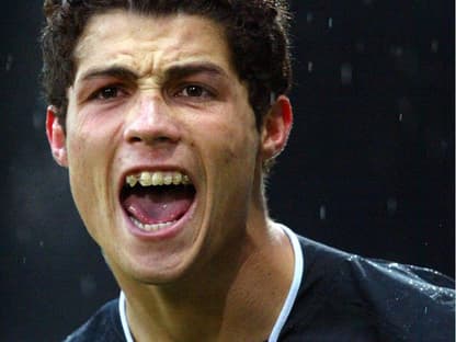 Cristiano Ronaldo mit Zahnspange, 2005