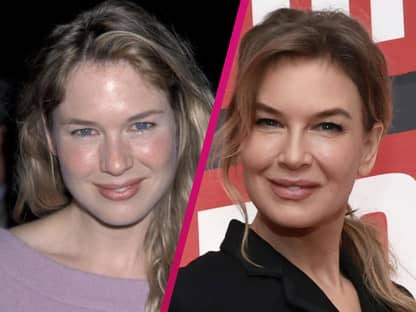 Renee Zellweger früher und heute