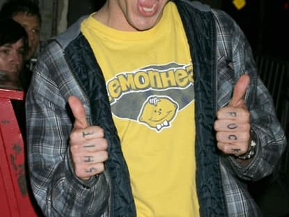 "Jackass"-Star Steve-O