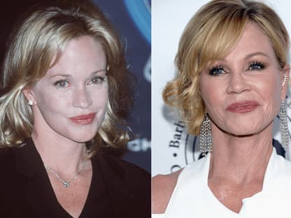 Melanie Griffith früher und heute