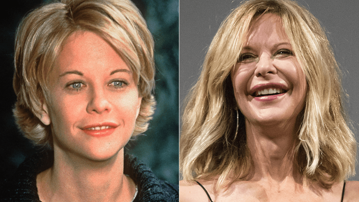 Die Krassesten Beauty Transformationen Der Stars