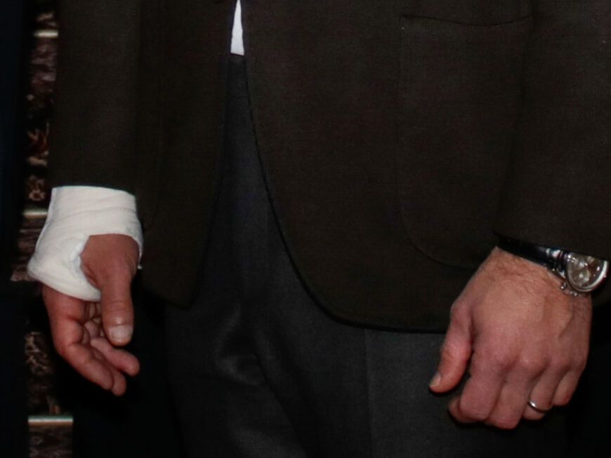 Prinz Carl Philips verletzte Hand in einem Gips. 